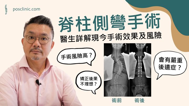 A clinician explains scoliosis surgery
